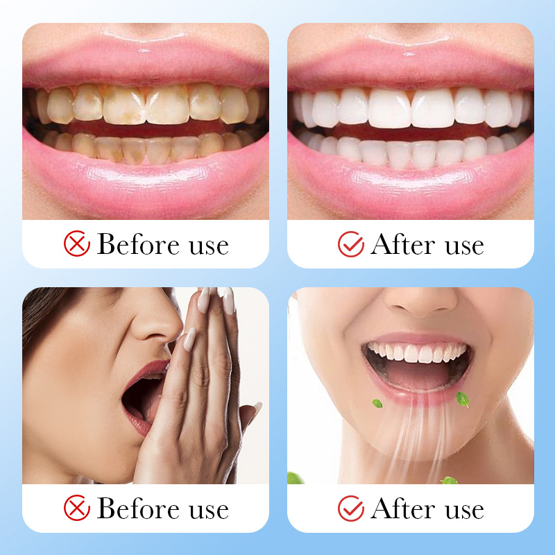 Aktivkohle aus Bambuskohle, Za – Teeth Whitening Charcoal Bewertung und Preis