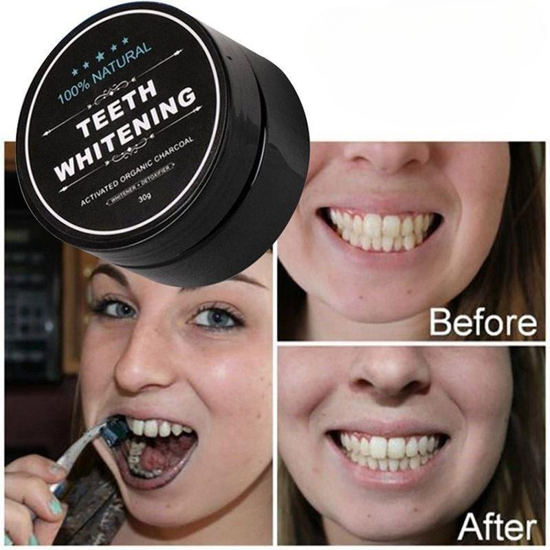1 Box Aktivkohle-Zahnaufhellun – Teeth Whitening Charcoal Bewertung und Preis
