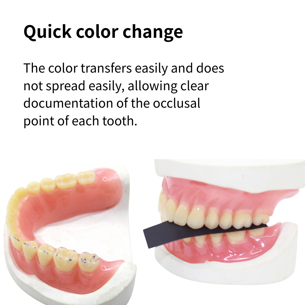 AG 300 Stück Okklusionspapier  – Teeth Whitening Strips Bewertung und Preis